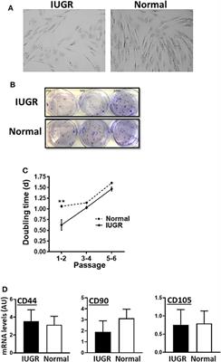 Differentiation Potential of Mesenchymal Stem/Stromal Cells Is Altered by Intrauterine Growth Restriction